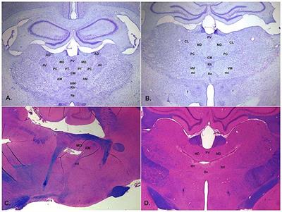 Central Thalamic-Medial Prefrontal Control of Adaptive Responding in the Rat: Many Players in the Chamber
